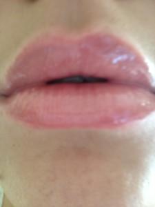Lips after