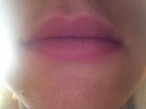 Lips before